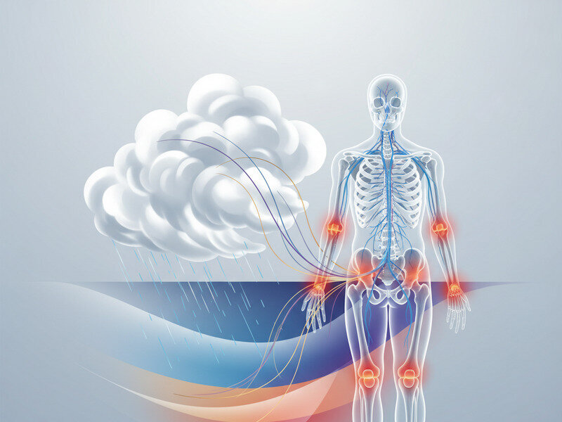 How to Log and Analyze Weather vs. Pain Patterns hero image