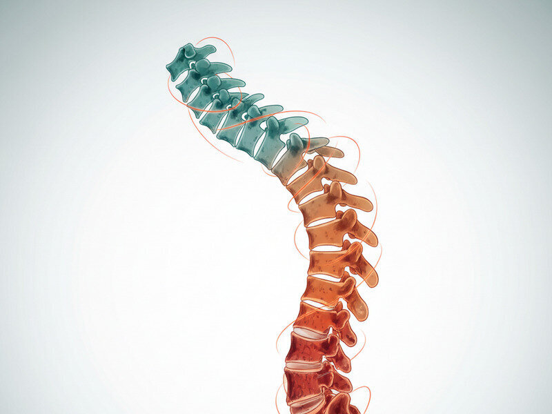 Daily Posture Mistakes That Make Ankylosing Spondylitis Worse hero image